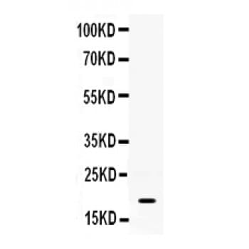 Polyclonal Rabbit anti-Mouse S100A8 / MRP8 Antibody (aa2-89, IHC, WB)