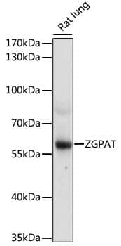 Polyclonal Rabbit anti-Human ZGPAT Antibody (WB)