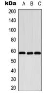 Polyclonal Rabbit anti-Human CYP8B1 Antibody (Internal, WB)