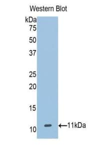 SLC30A8 / ZNT8 Antibody (aa1-80)