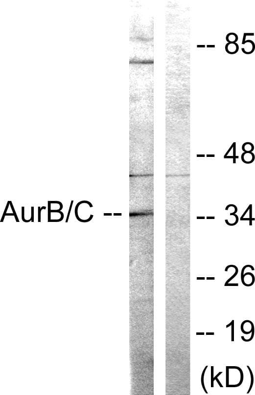 Polyclonal Rabbit anti-Human Aurora Kinase B+C Antibody (p202/175, WB)