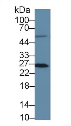 MSRA Antibody (aa27-235, PE)