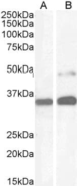 IHC-plus™ PAX8 Antibody (aa2-14)