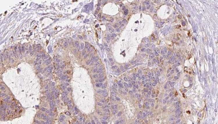 RAB3D Antibody
