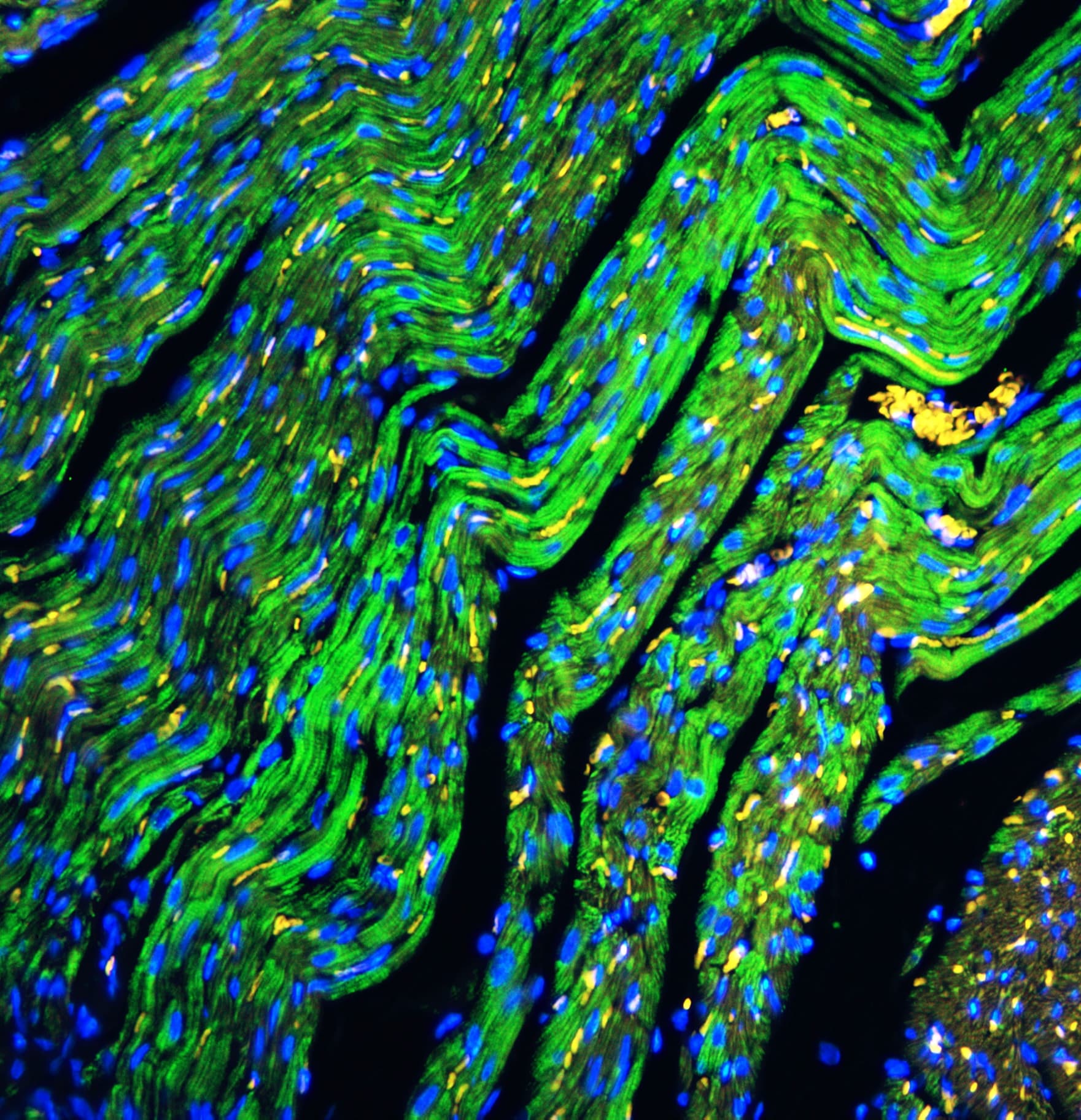 Polyclonal Rabbit anti-Human CYCS / Cytochrome c Antibody (aa2-105, IHC, WB)