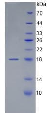 Human VWF / Von Willebrand Factor Protein (Recombinant His, N-Terminal)