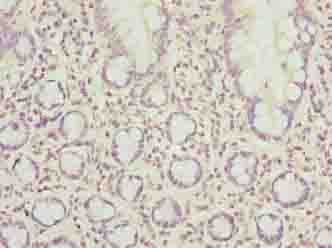 Polyclonal Rabbit anti-Human SCAPER Antibody (IHC)
