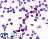 IHC-plus™ GPRC5A / RAI3 Antibody (Extracellular Domain)