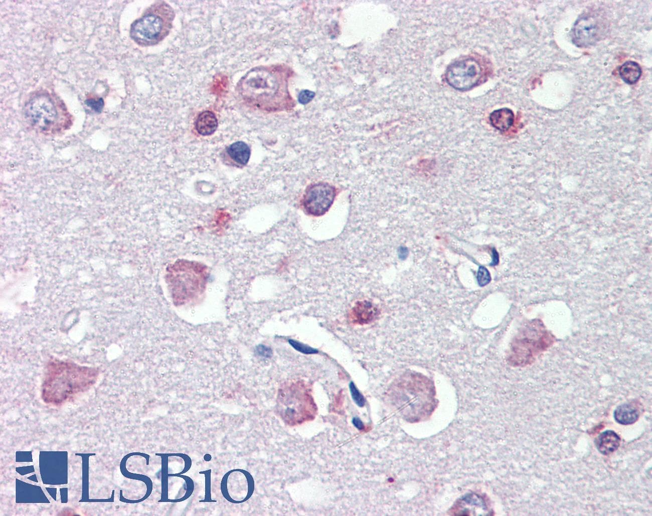IHC-plus™ FEZ1 Antibody (aa278-290)