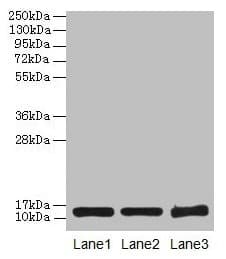 SNCG / Gamma-Synuclein Antibody (aa1-127)