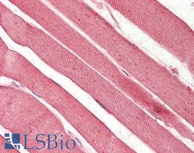 IHC-plus™ RAB7A / RAB7 Antibody (C-Terminus)