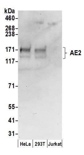 SLC4A2 / AE2 Antibody (aa1-50)