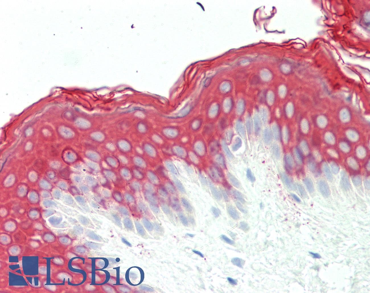 IHC-plus™ KRT10 / CK10 / Cytokeratin 10 Antibody (aa150-179)