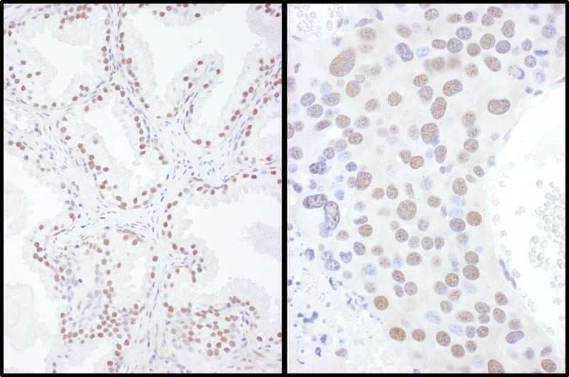 SAE2 / UBA2 Antibody (aa525-575)
