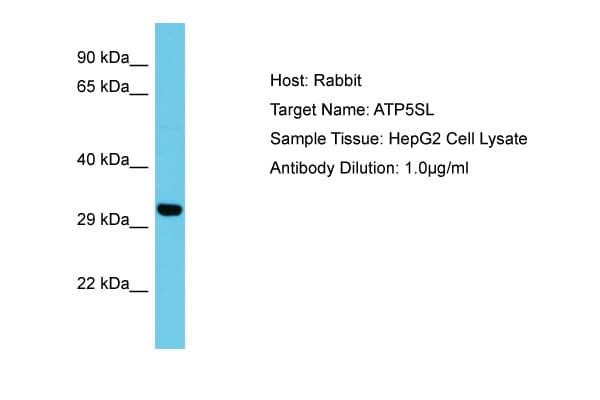 Polyclonal Rabbit anti-Human ATP5SL Antibody (aa38-87, WB)