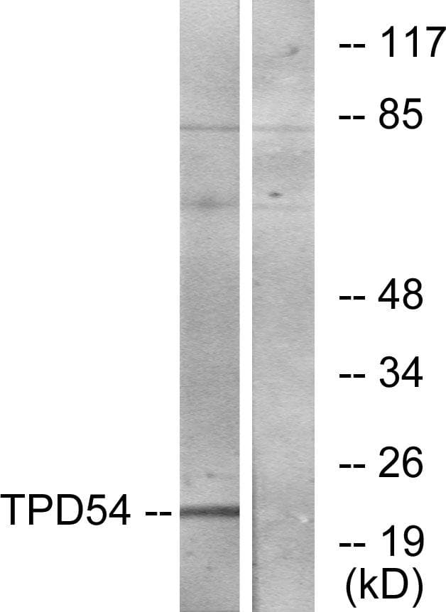 Polyclonal Rabbit anti-Human TPD52L2 / HD54 Antibody (WB)
