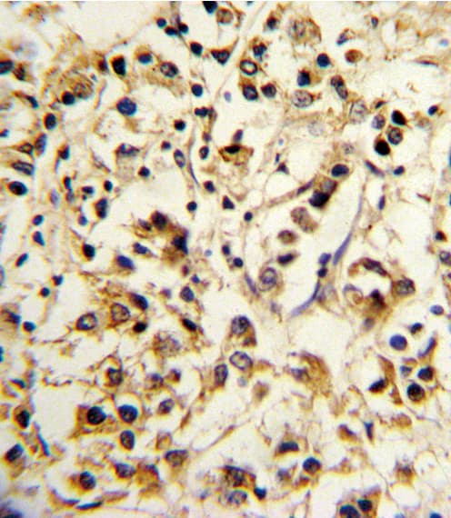 KIR2DL4 Antibody (aa296-323)