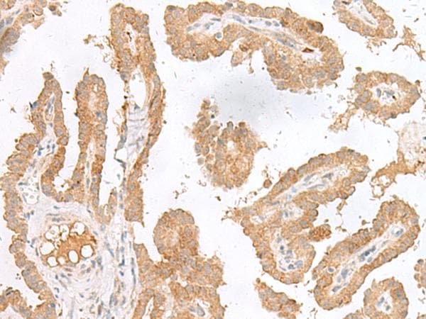 Polyclonal Rabbit anti-Human CXCL6 Antibody (IHC)