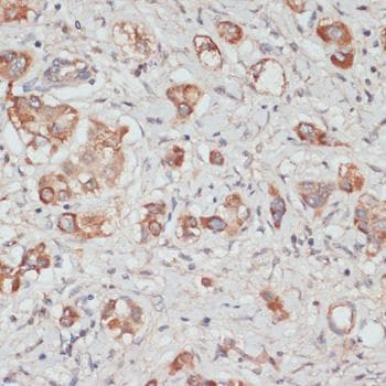 Polyclonal Rabbit anti-Human TES / Testin Antibody (IHC)