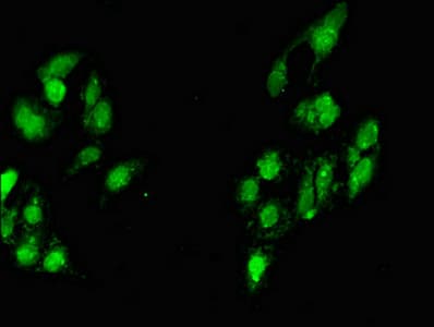 Polyclonal Rabbit anti-Human MYF6 / MRF4 Antibody (IHC, IF, WB)
