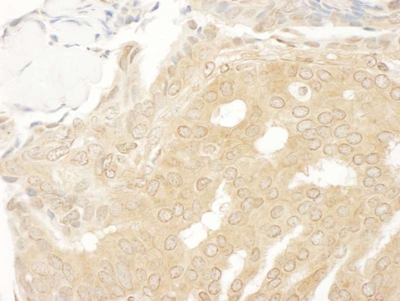 Polyclonal Rabbit anti-Human MAP2K2 / MKK2 / MEK2 Antibody (aa1-50, IHC)