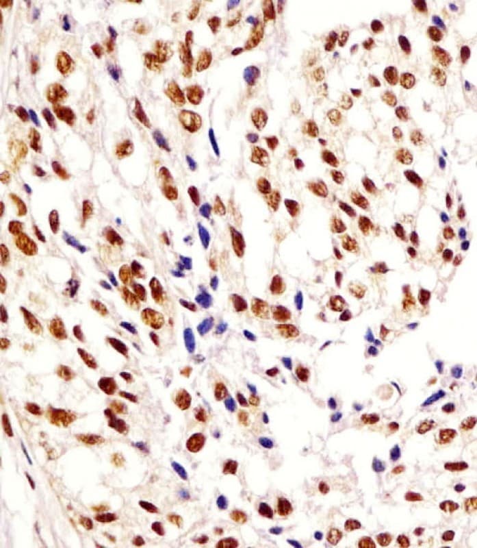 Polyclonal Rabbit anti-Human HNRNPA1L2 Antibody (aa22-56, IHC, WB)