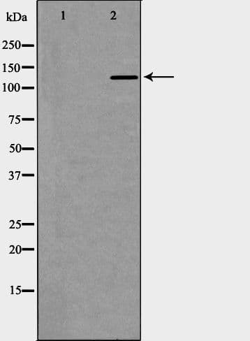 IRS1 Antibody