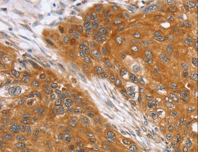 Polyclonal Rabbit anti-Human SLC25A13 / CITRIN Antibody (IHC, WB)