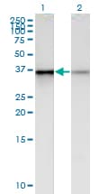 Monoclonal Mouse anti-Human HPH2 / PHC2 Antibody (clone 1F4, WB)