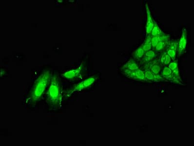 NANOS1 / NOS1 Antibody