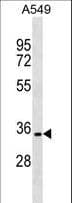 GLUP / PACRG Antibody (aa46-74)