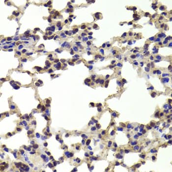 Polyclonal Rabbit anti-Human HOXB1 Antibody (IHC, WB)
