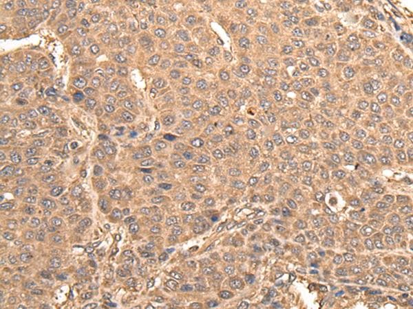 Polyclonal Rabbit anti-Human BUD31 Antibody (IHC, WB)