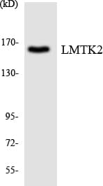 IHC-plus™ KPI-2 / LMTK2 Antibody (aa636-685)