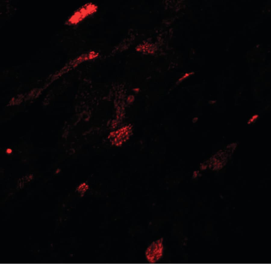 IHC-plus™ TGM5 / Transglutaminase 5 Antibody