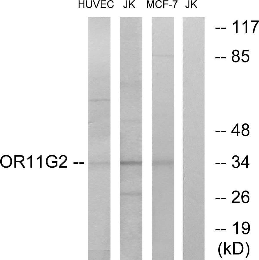 OR11G2 Antibody (aa241-290)