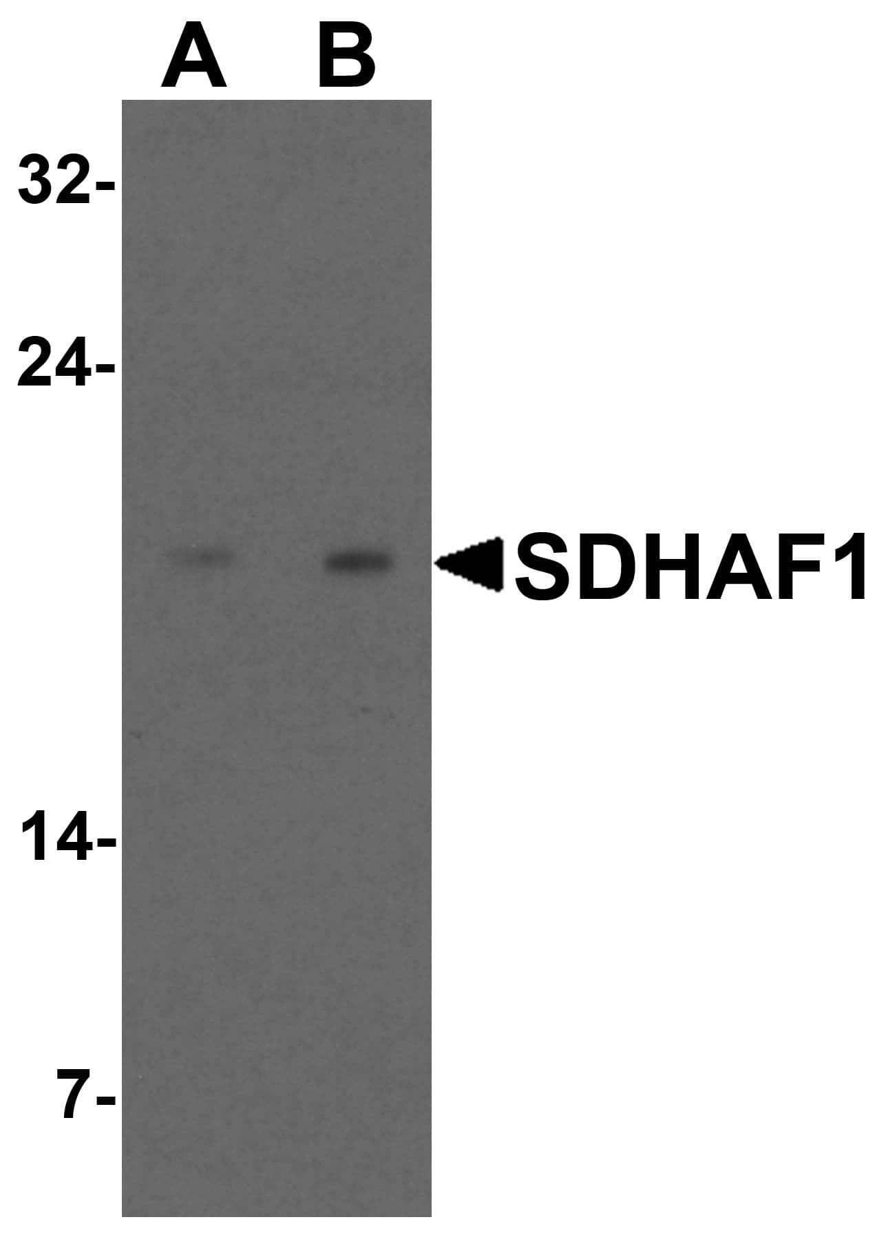 IHC-plus™ SDHAF1 Antibody