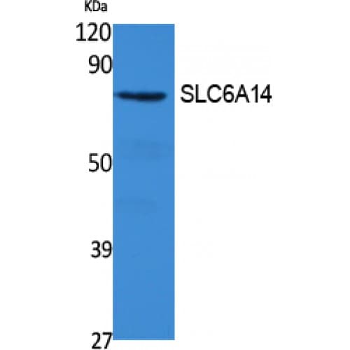 Polyclonal Rabbit anti-Human SLC6A14 Antibody (C-terminal, WB)