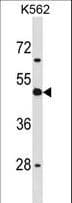 Polyclonal Rabbit anti-Human CD1D Antibody (aa177-206, WB)