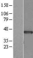 ACTC1 / Alpha Cardiac Actin Protein (Over-Expression Lysate Myc-DDK (Flag))
