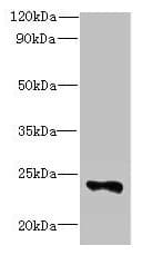 FAM156A / TMEM29 Antibody