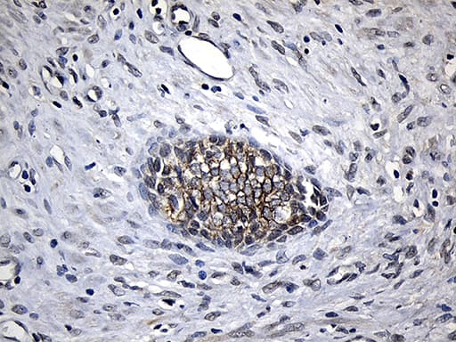 CPT1B Antibody (aa187-440, clone OTI2A6, Carrier-free)