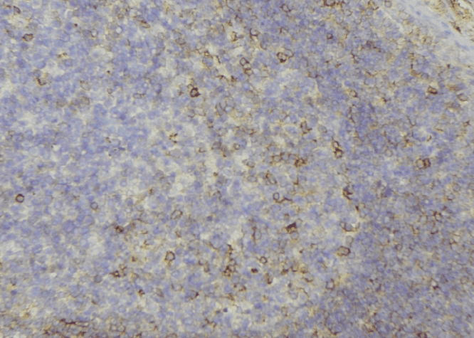 KRT81 / Keratin 81 / KRTHB1 Antibody