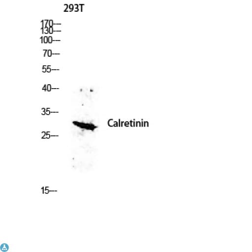 CALB2 / Calretinin Antibody