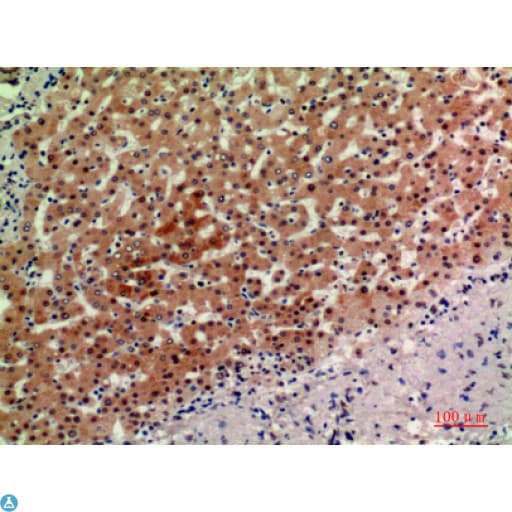 ACER2 Antibody
