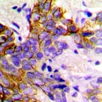 GABARAP Antibody