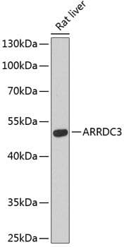 Polyclonal Rabbit anti-Human ARRDC3 Antibody (WB)