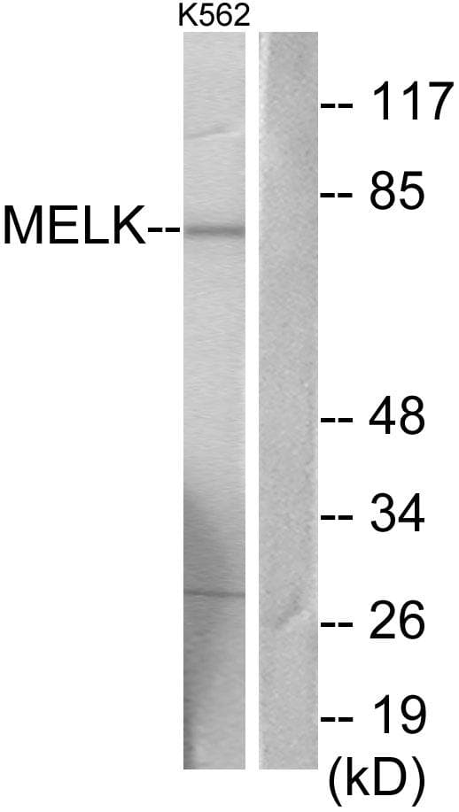 MELK Antibody