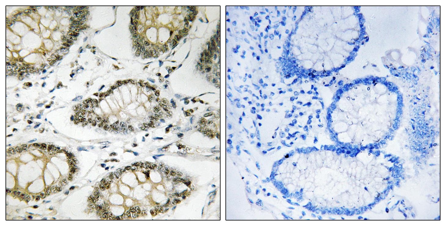 ATR Antibody (phospho-Ser428)