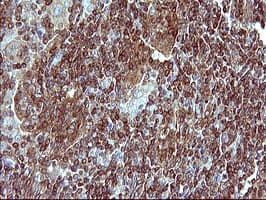 Monoclonal Mouse anti-Human MLANA / Melan-A Antibody (clone OTI2G2, IHC, IF, WB)